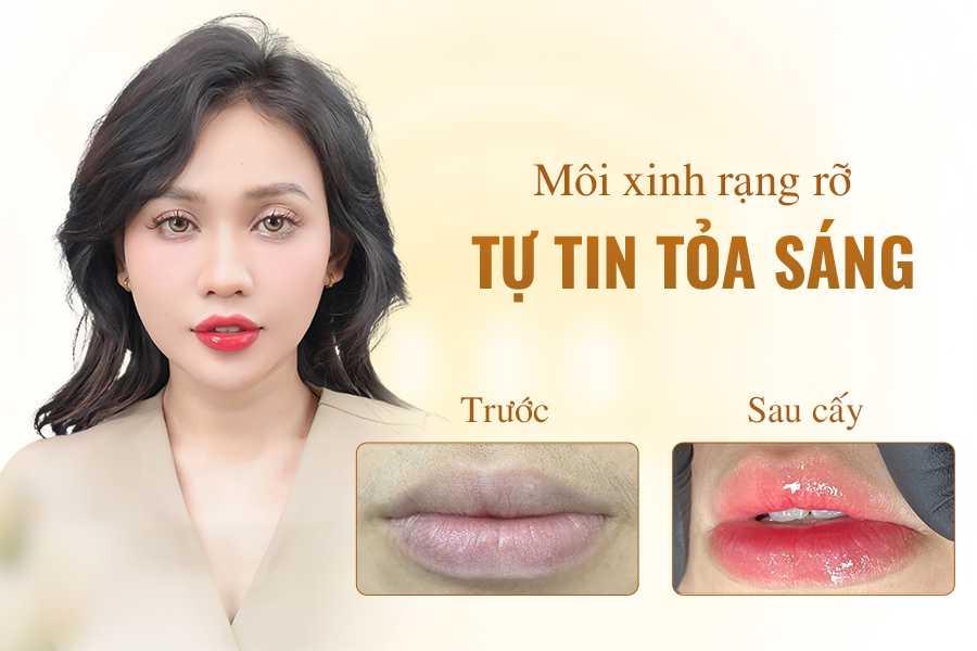 cấy môi sinh học