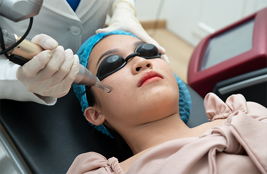 Mẹo trị nám tàn nhang ở phụ nữ sau sinh an toàn 4 nám tàn nhang ở phụ nữ sau sinh